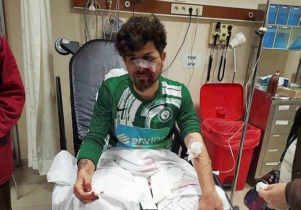 Kırmızı kart görünce rakibinin suratını tekmeledi