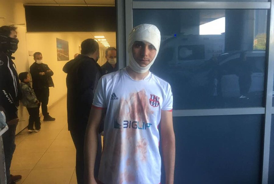 Futbolcu Okan Kaya’nın olaylarda çenesi kırıldı