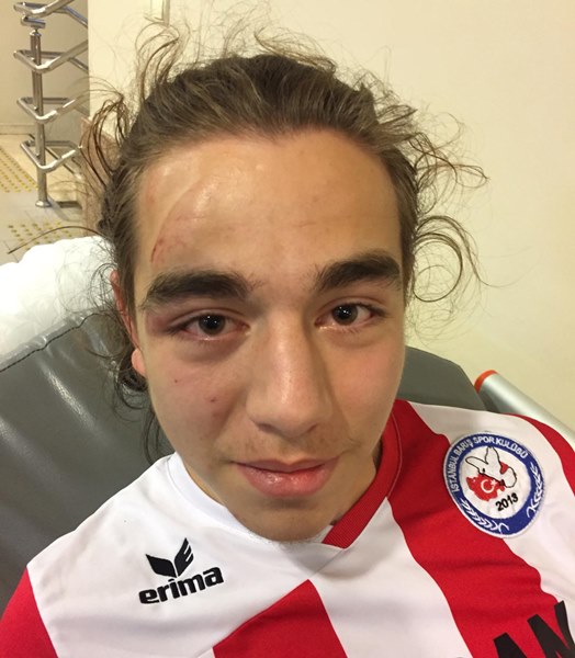 Emircan Akkaya’nın durumu düzeliyor