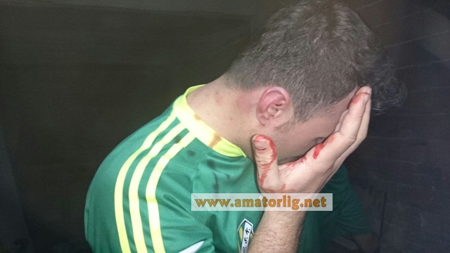 Dayaktan kaçmak için kömürlüğe sığındılar